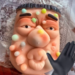 Satisfying Zit Squeeze Stress Relief Toy
